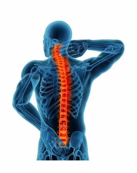 عکس کارتونی ستون فقرات