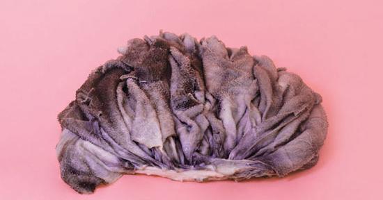 عکس معده ی گاو