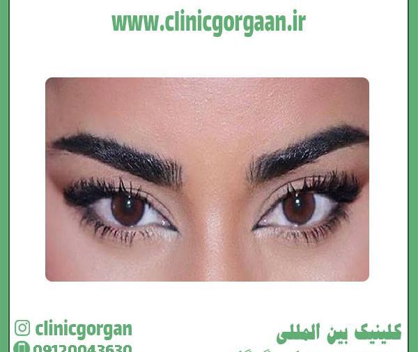 عکس چشم گربه ای درشت