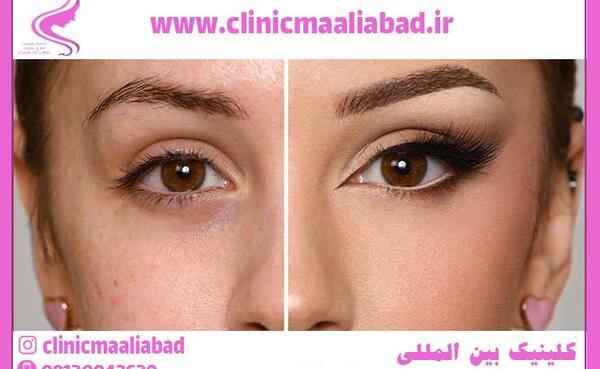 عکس چشم گربه ای درشت