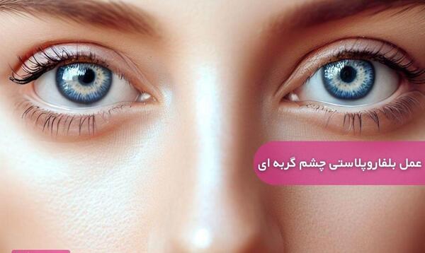 عکس چشم گربه ای درشت