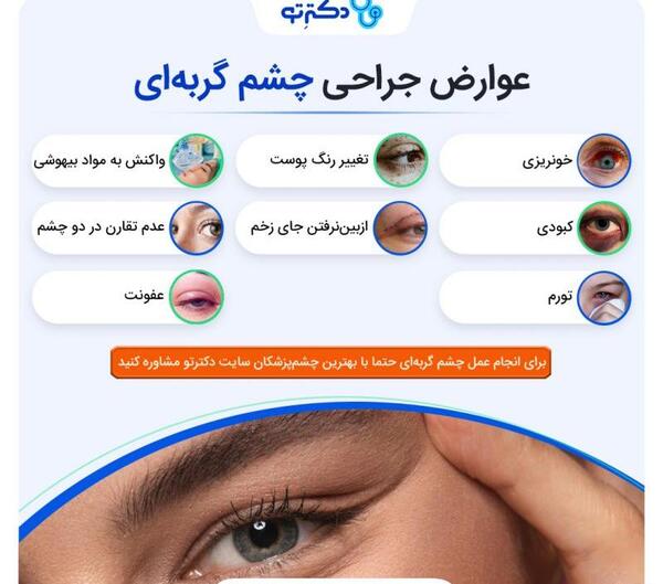 عکس چشم گربه ای درشت