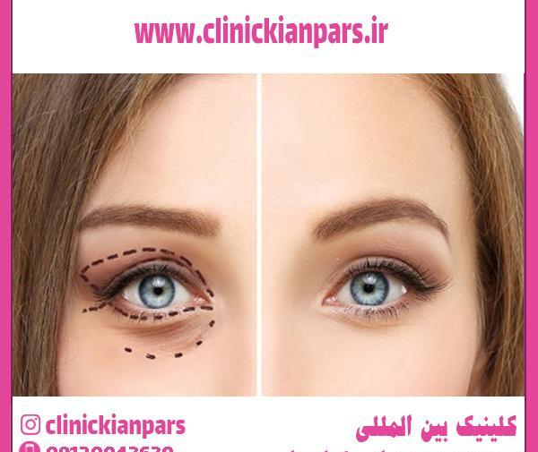عکس چشم گربه ای درشت