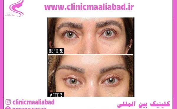عکس چشم گربه ای درشت