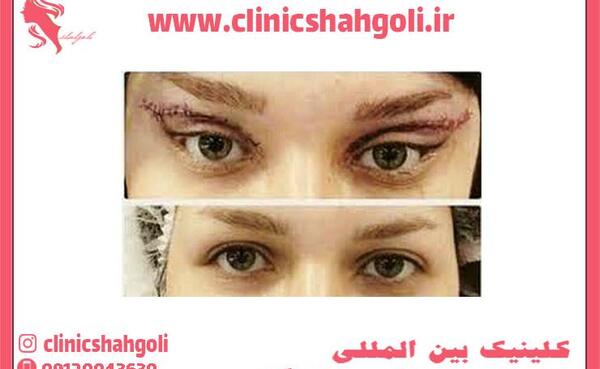 عکس چشم گربه ای درشت