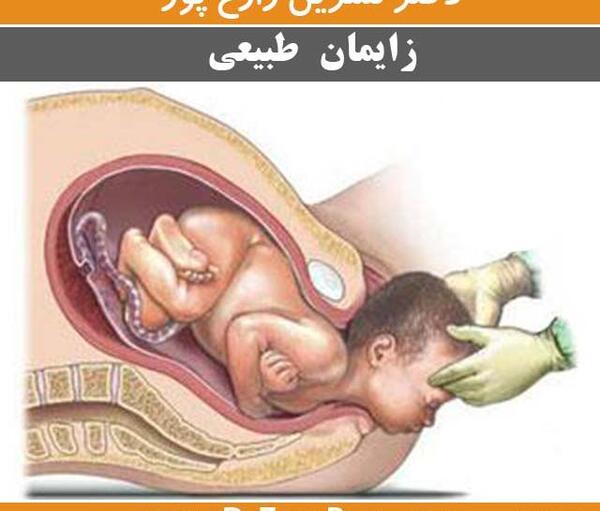 مادر عکس زایمان طبیعی از نزدیک