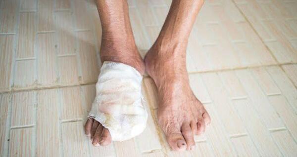 عکس پای زخمی مرد