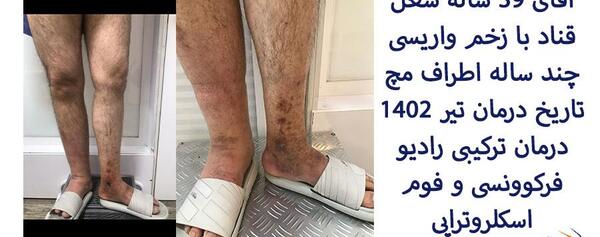 عکس پای زخمی مرد
