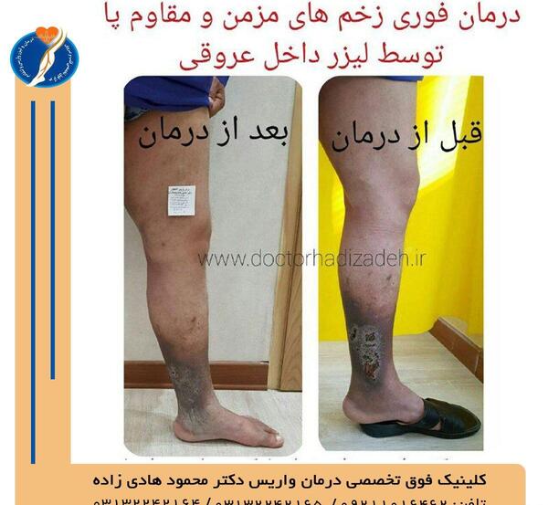 عکس پای زخمی مرد