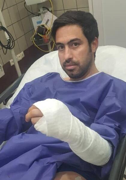 عکس دست مرد زخمی