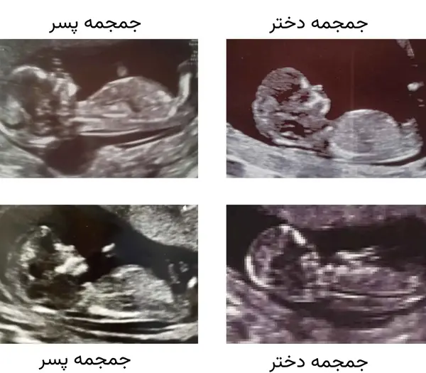 عکس جنین ماه سوم