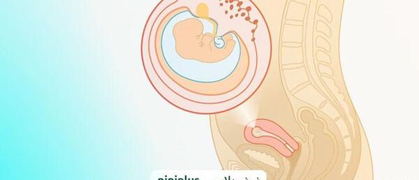 عکس جنین۵ ماه