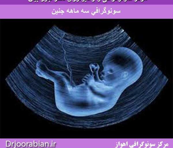 عکس سه ماه جنین