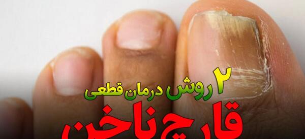 عکس قارچ گرفتن ناخن