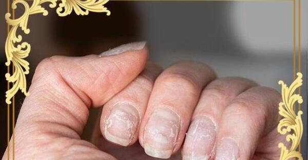 عکس هوا گرفتن ناخن