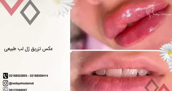 عکس ژل لب اردکی