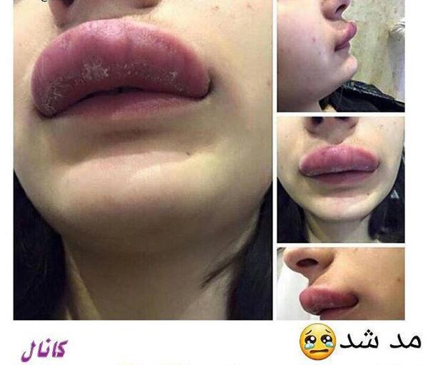 عکس ژل لب اردکی