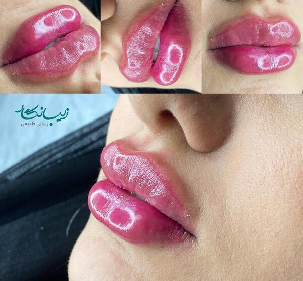 عکس ژل لب اردکی