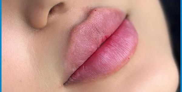 عکس ژل لب اردکی