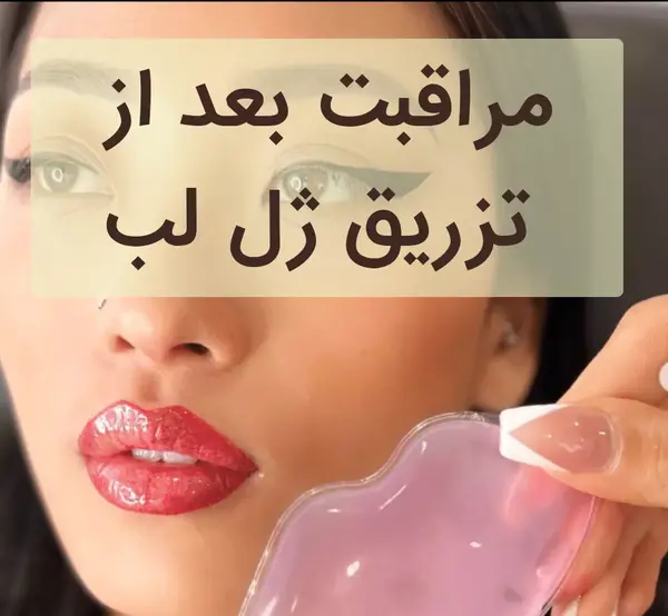 عکس ژل لب اردکی