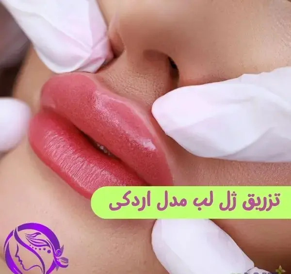 عکس ژل لب اردکی