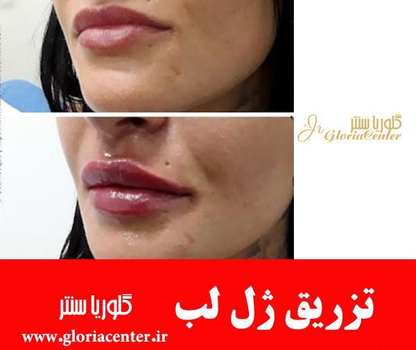 عکس ژل لب اردکی