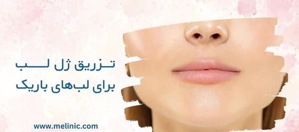 عکس ژل لب اردکی