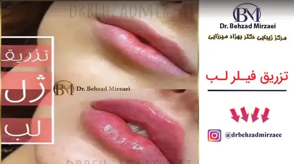 عکس ژل لب اردکی