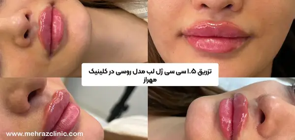 عکس مدل لب اردکی