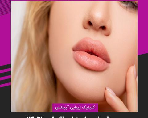 عکس مدل لب اردکی