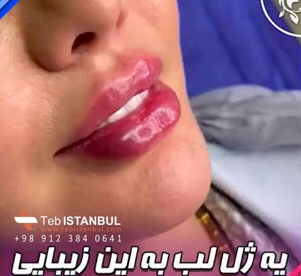 عکس مدل لب اردکی