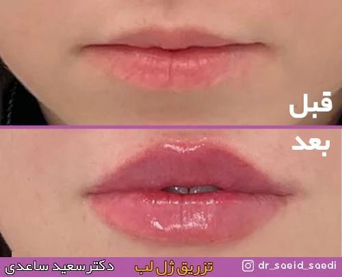 عکس مدل لب اردکی