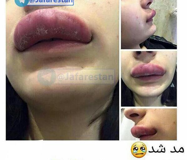 عکس مدل لب اردکی