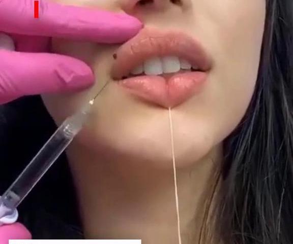 عکس مدل لب اردکی