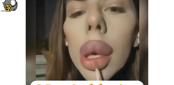 عکس لب پروتز خنده دار