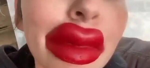عکس لب پروتز گنده