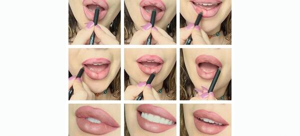 عکس لب پروتز گنده