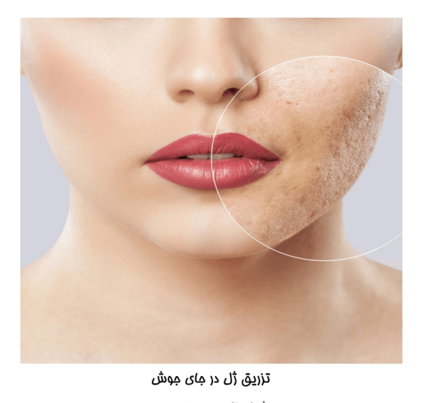 عکس لب جوشیده