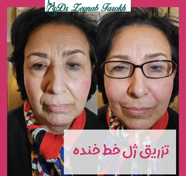 عکس لب جو