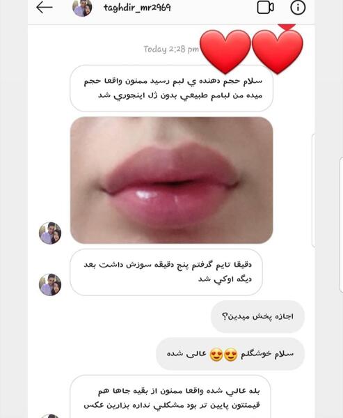 عکس رژ لب حجم دهنده