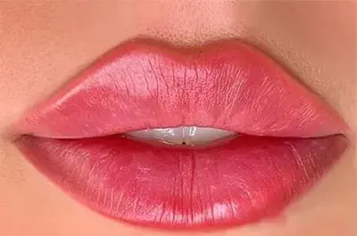 عکس لب ژل زده بزرگ