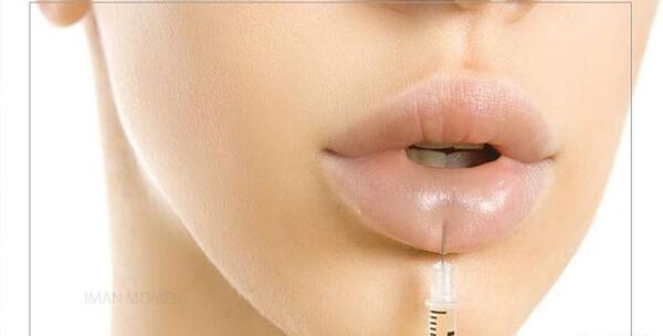 عکس تزریق ژل لب طبیعی