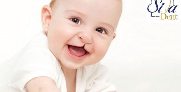عکس لب شکری دختر