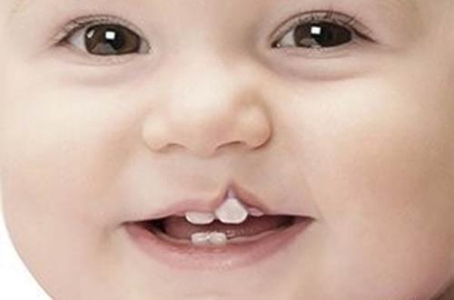 عکس لب شکری دختر
