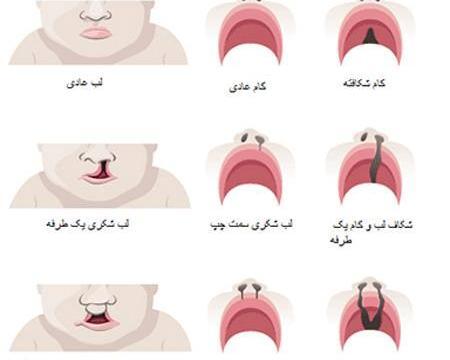 عکس لب شکری دختر