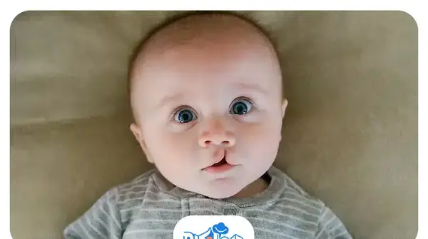 عکس لب شکری ها