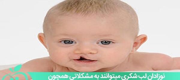 عکس نوزادان لب شکری