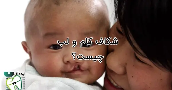 عکس بچه های لب شکری