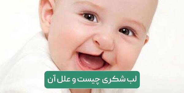 عکس بچه های لب شکری