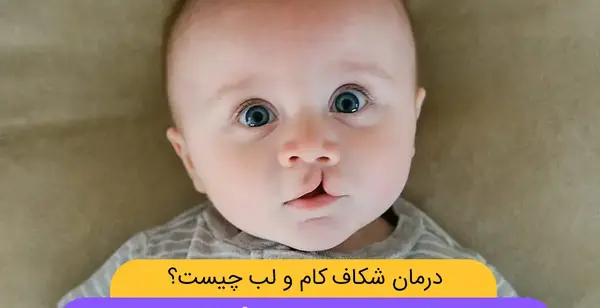 عکس بچه های لب شکری